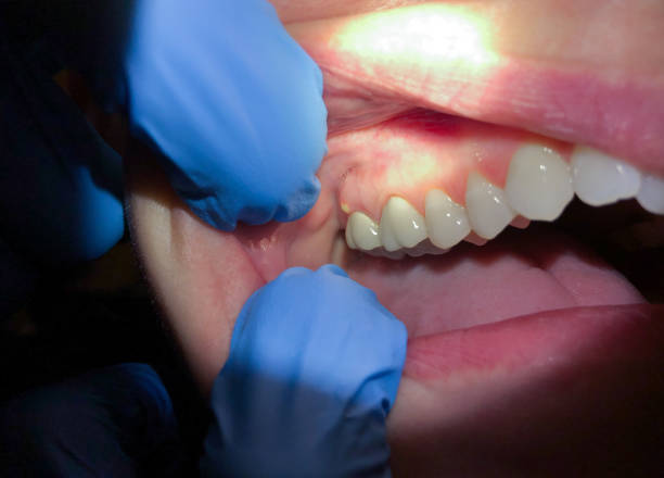 Best Orthodontic Emergency Dentist in Charlestown, MD
