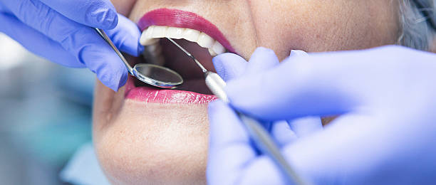 Best Emergency Dentist for Knocked-Out Tooth in Charlestown, MD